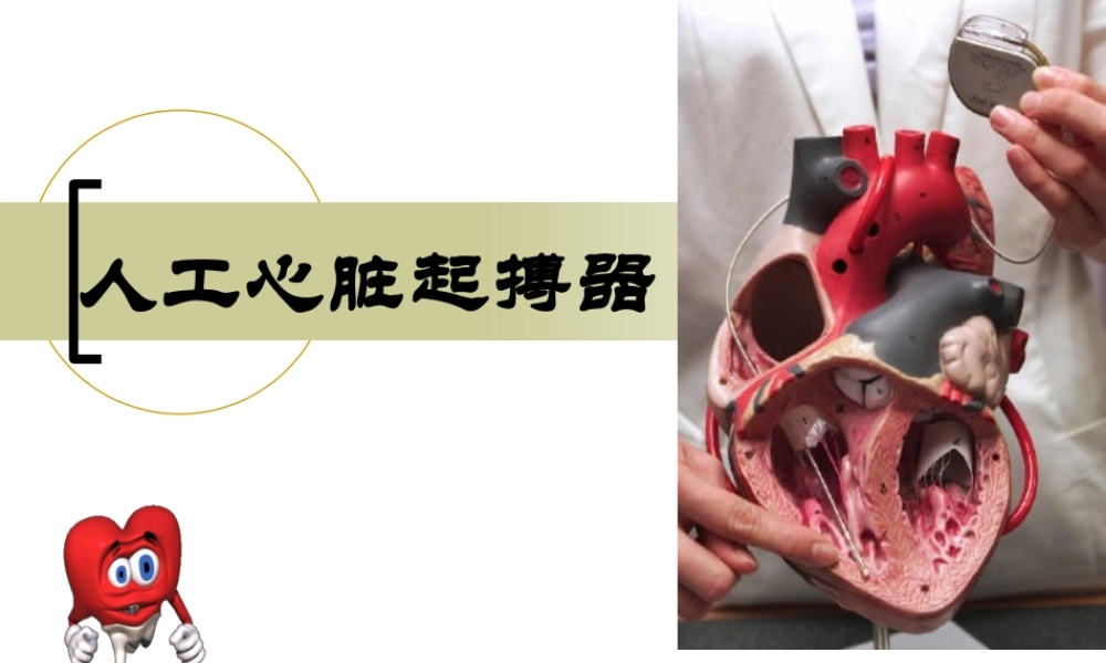 植入式心脏起搏器大全.ppt