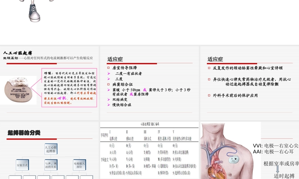 植入式心脏起搏器大全.ppt