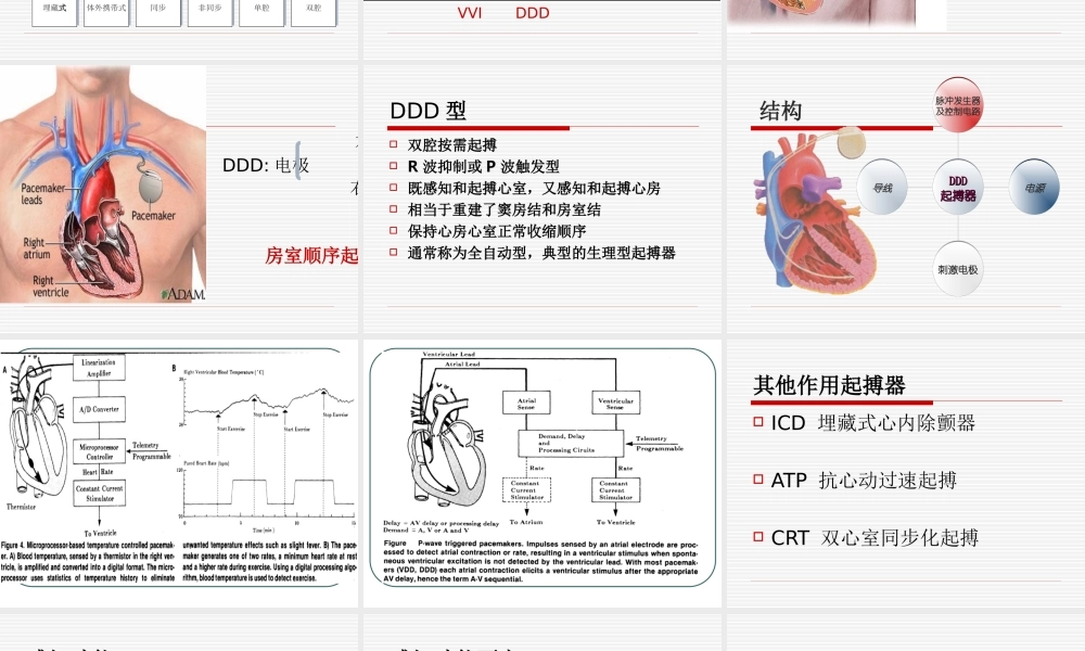植入式心脏起搏器大全.ppt