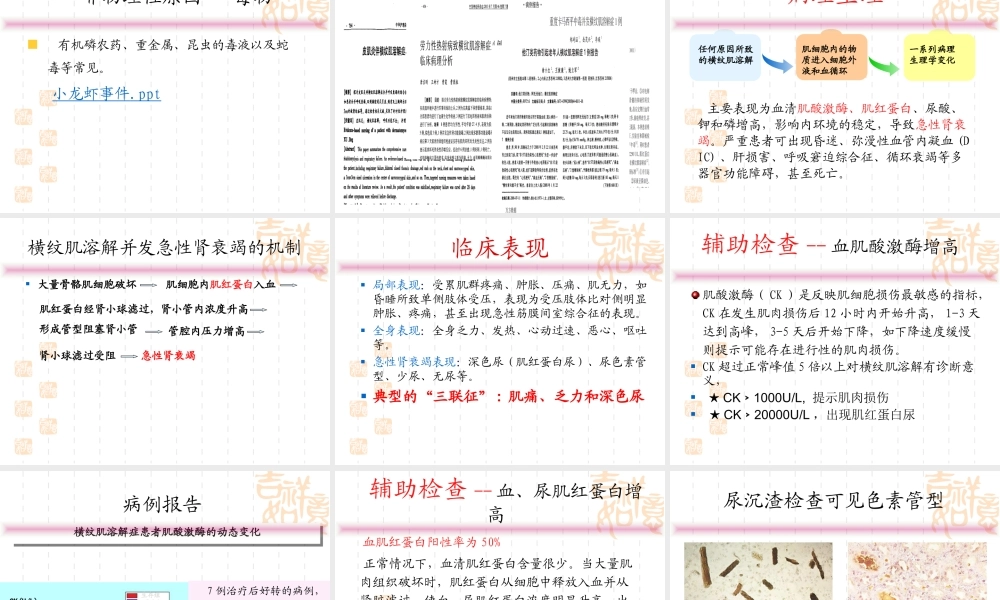 横纹肌溶解症sch.ppt