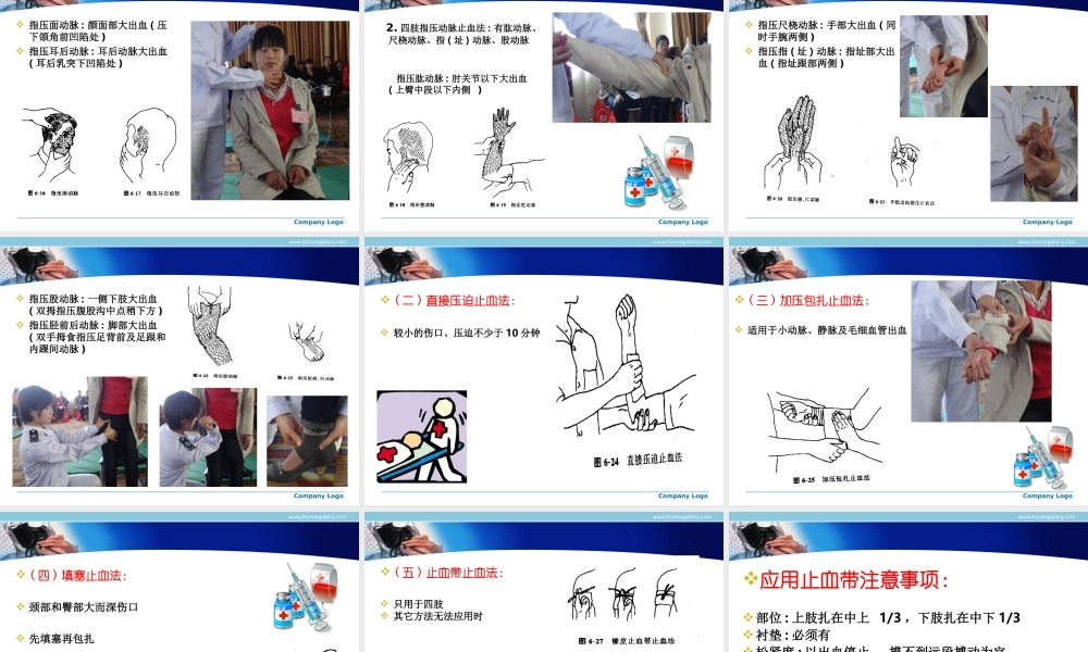 止血包扎转运院前急救.ppt