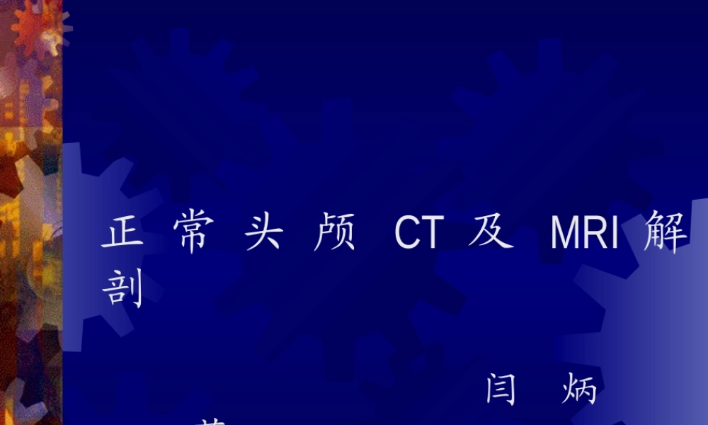 正-常-头-颅-CT-及-MRI-解-剖.ppt