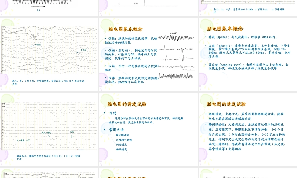 正确判断与应用小儿脑电图-.ppt