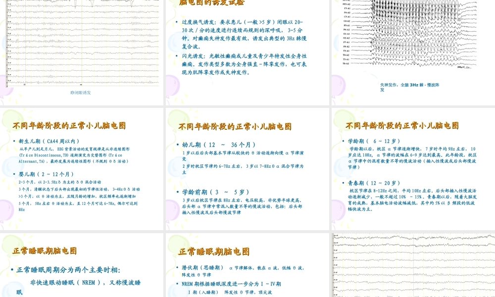 正确判断与应用小儿脑电图-.ppt