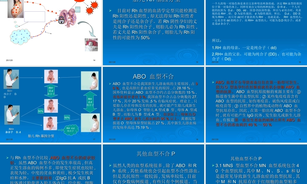 母儿血型不和原理---Rh1.ppt