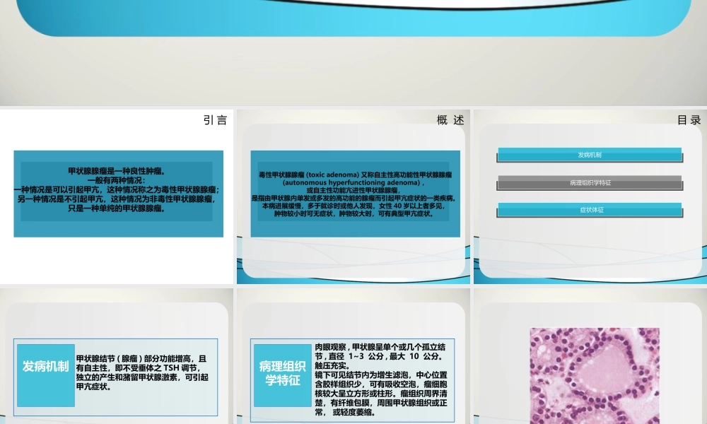毒性甲状腺腺瘤规范.ppt