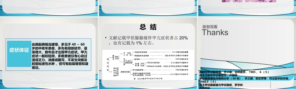 毒性甲状腺腺瘤规范.ppt