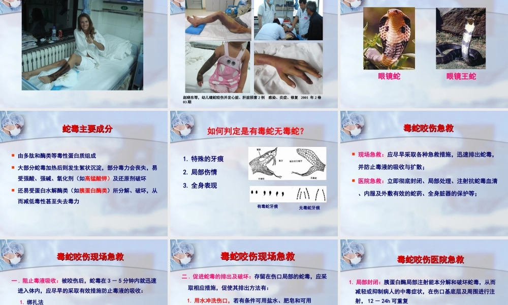 毒蛇、毒虫咬伤的急诊救治(1).ppt