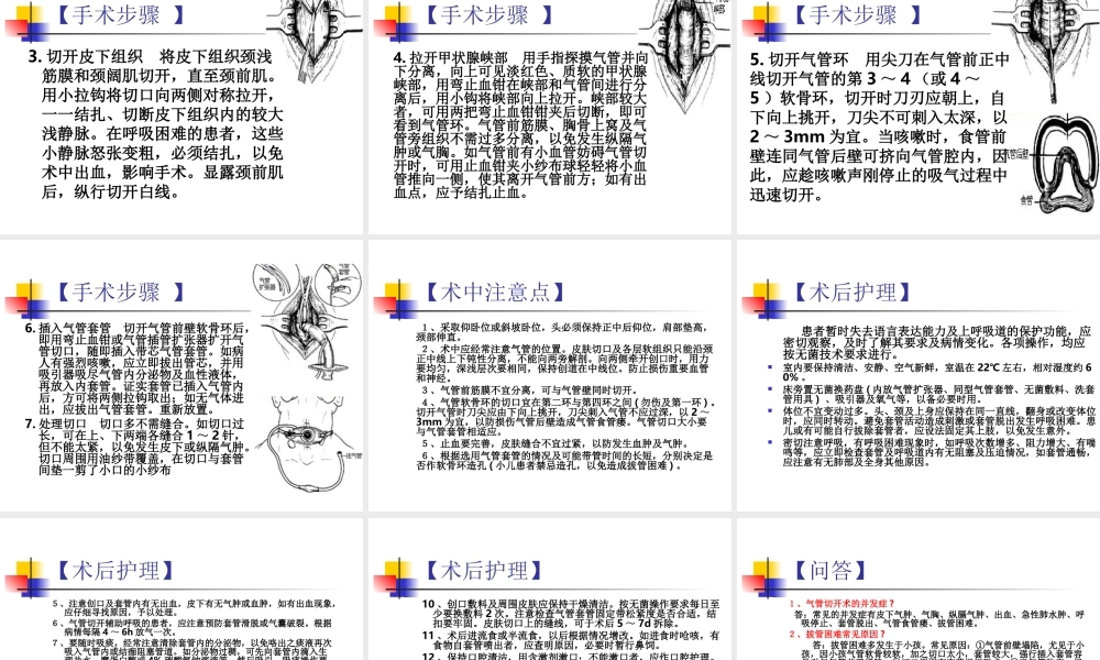 气管切开及环甲膜穿刺.ppt