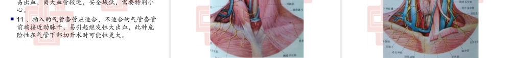 气管切开术PPT..ppt