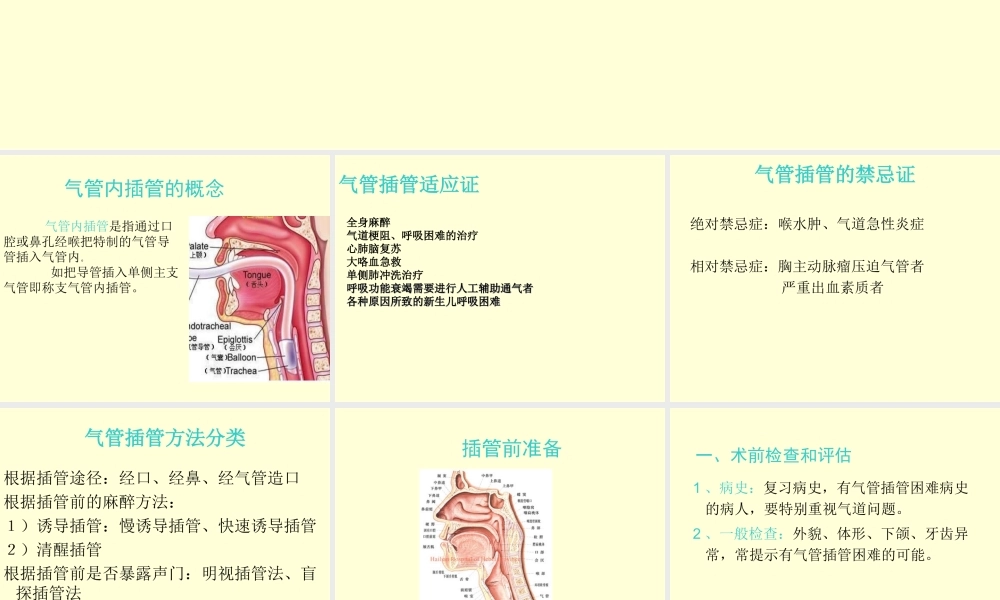 气管插管与肺隔离术.ppt