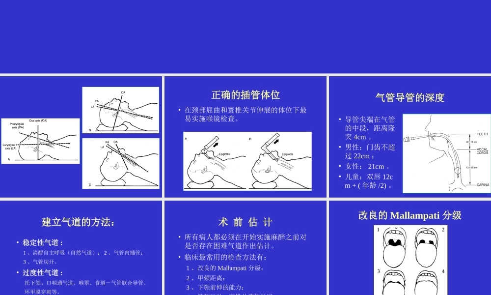 气管插管及困难气道.ppt