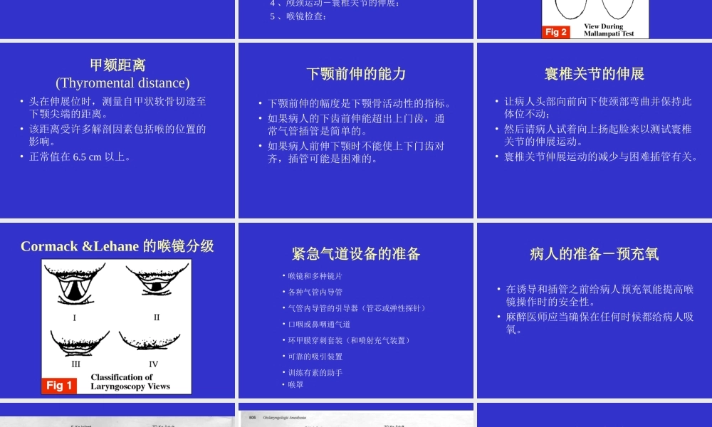 气管插管及困难气道.ppt