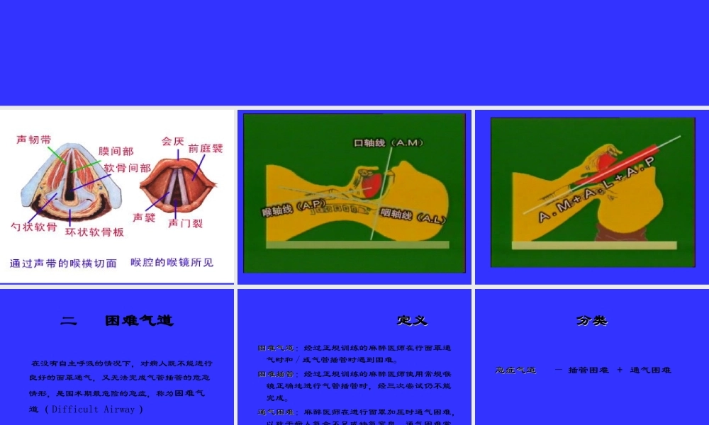 气管插管及困难气道的处理.ppt