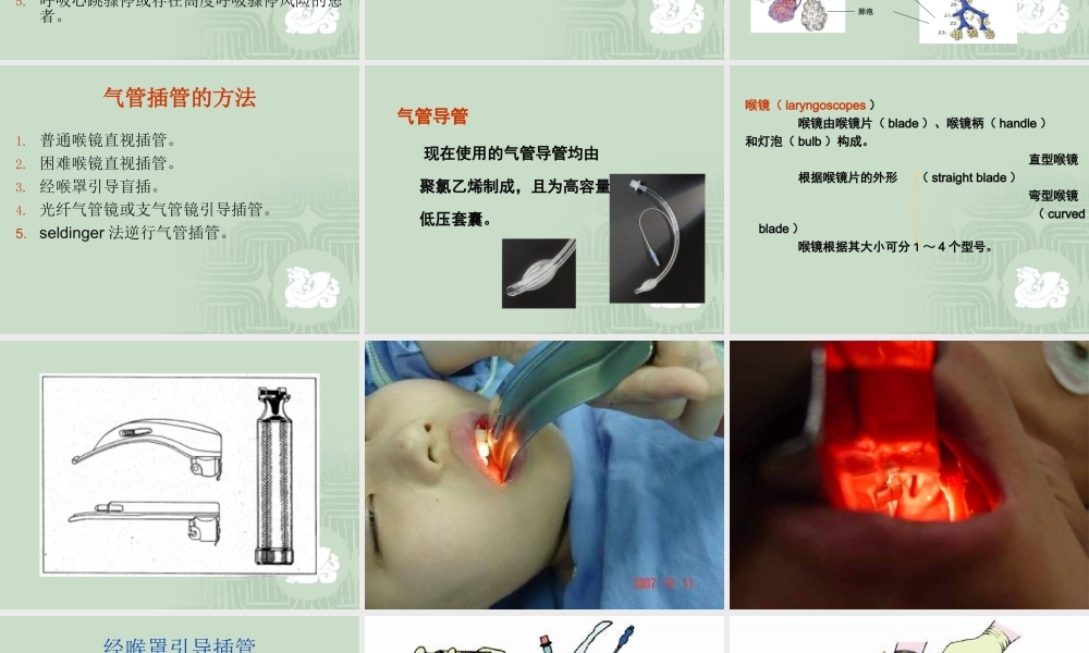 气管插管术.ppt