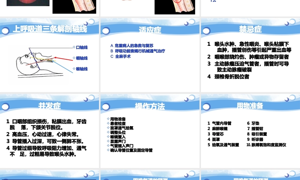 气管插管术-祁林PPT.pptx