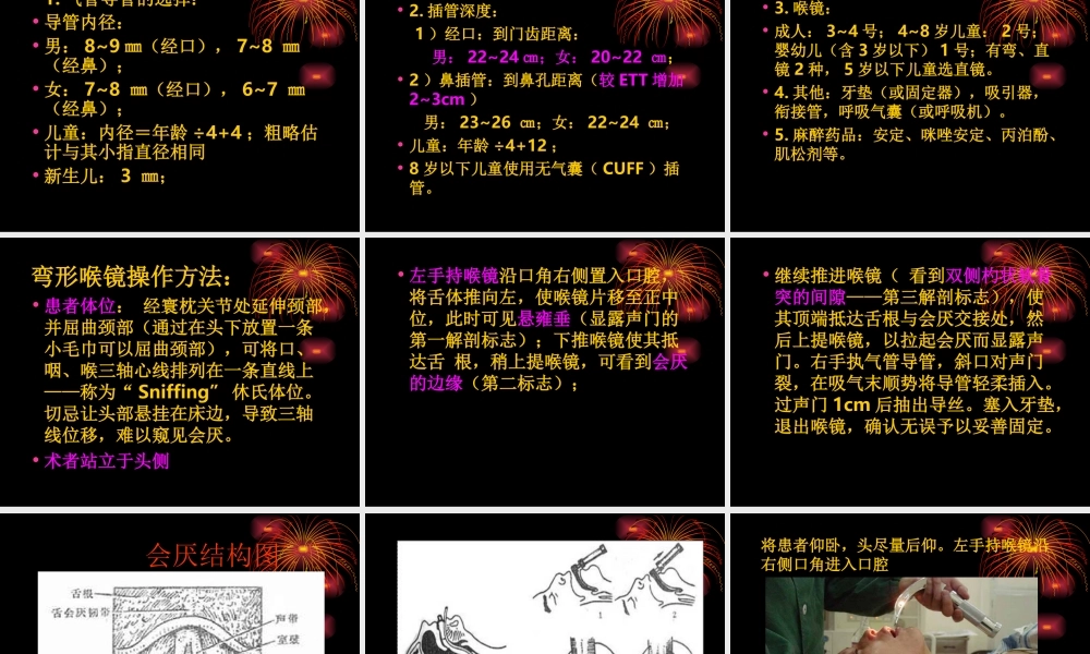 气管插管术马磊.ppt