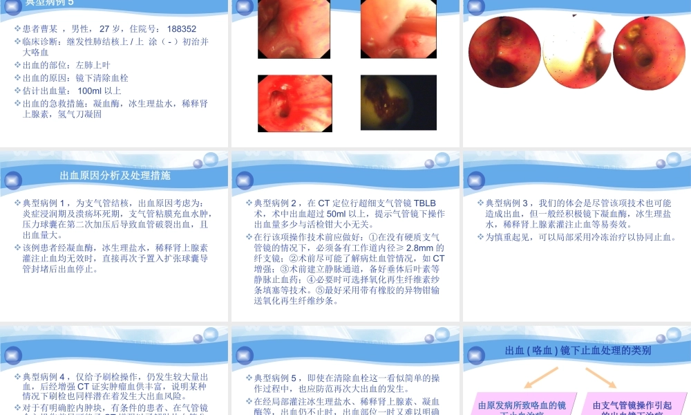 气管镜介入相关大出血处理策略.ppt