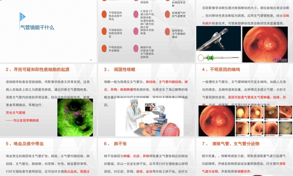 气管镜其实并不可怕-郝万明.pptx