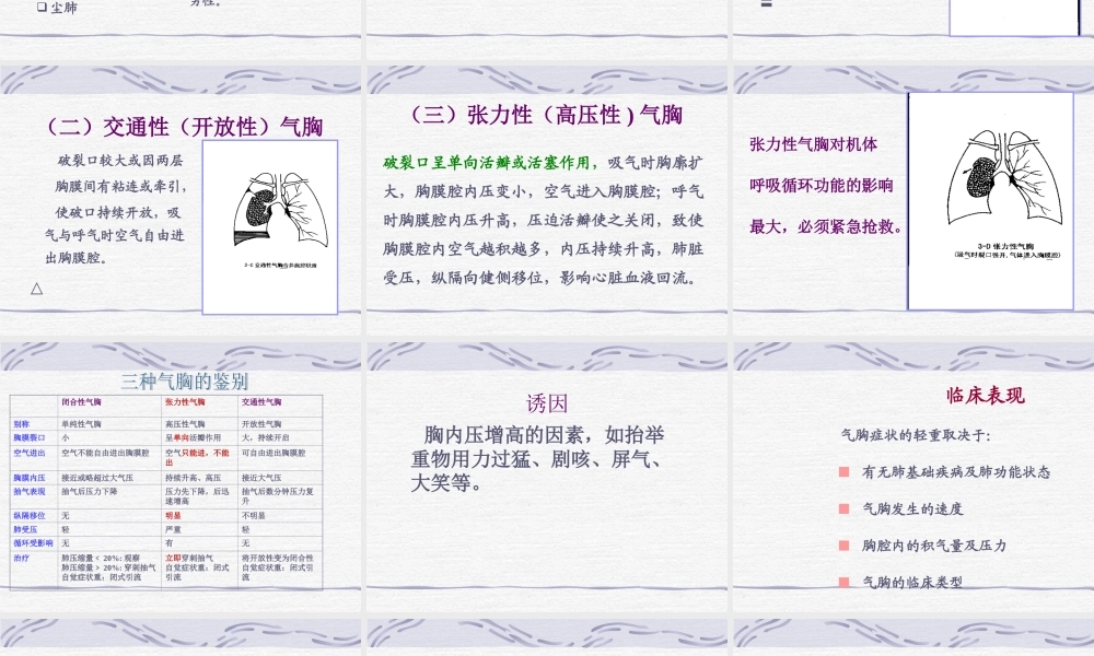 气胸-精美PPT.ppt