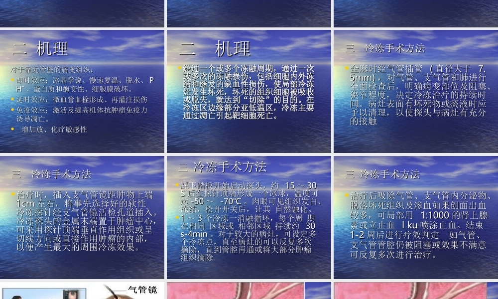 气道肿物冷冻0801032017.ppt