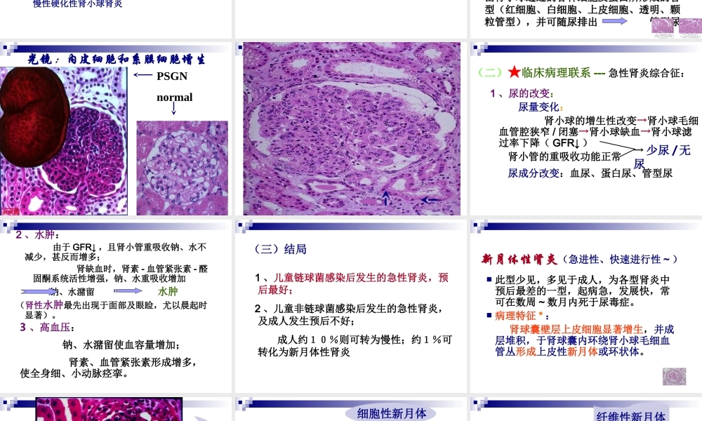 泌尿系统(new2011-5).ppt