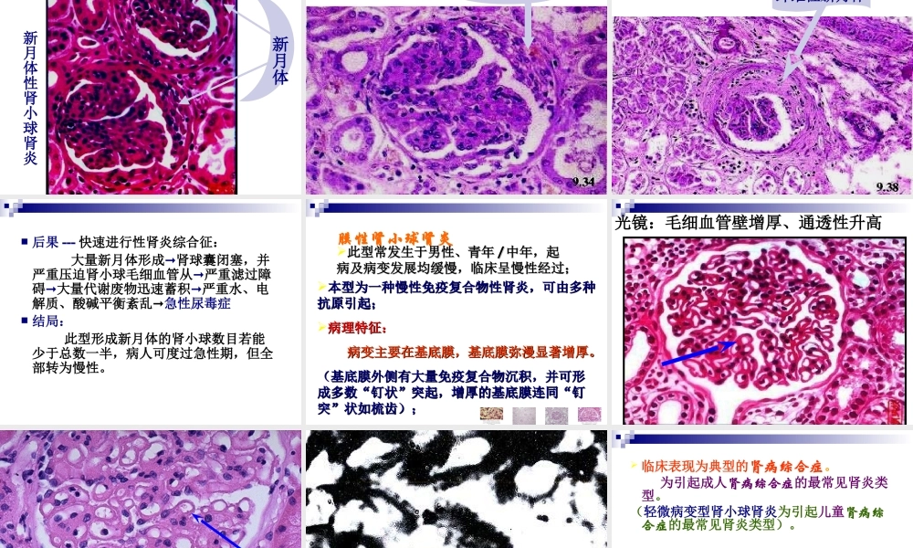 泌尿系统(new2011-5).ppt