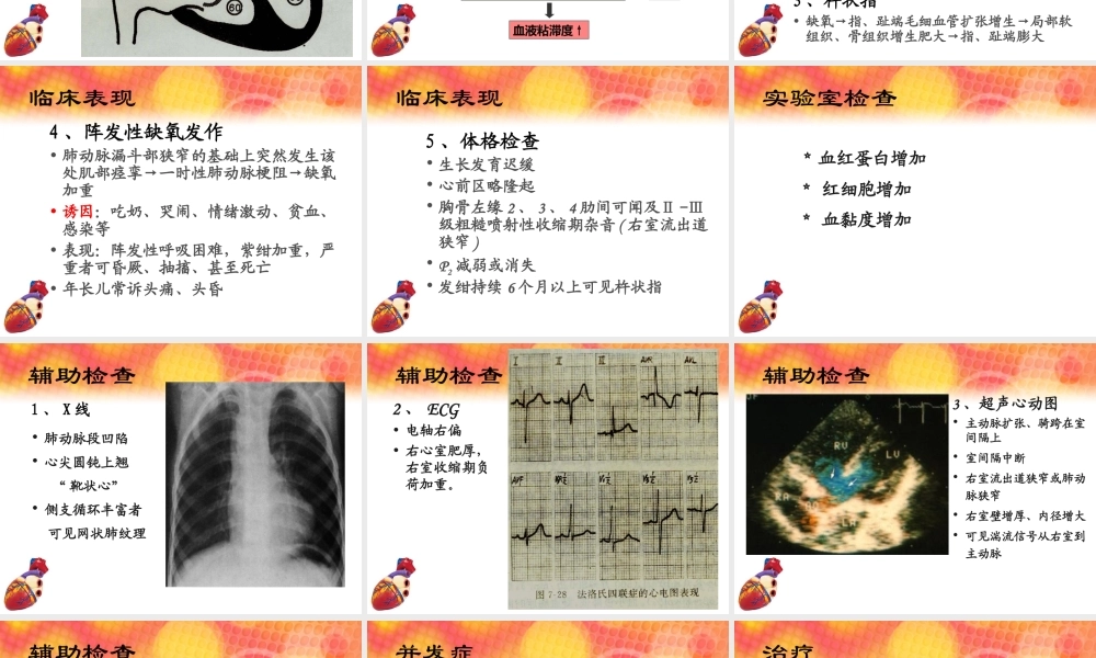 法洛氏四联症(TOF).ppt