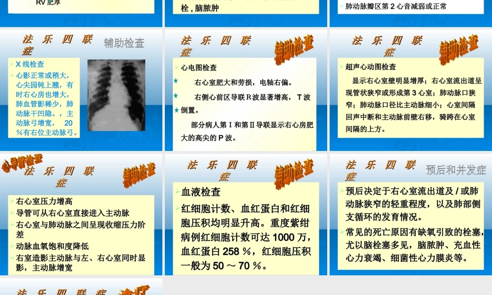 法洛四联症..ppt