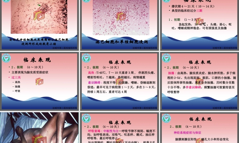 流行性乙型脑炎-运城传染病医院-卫志干研究.ppt