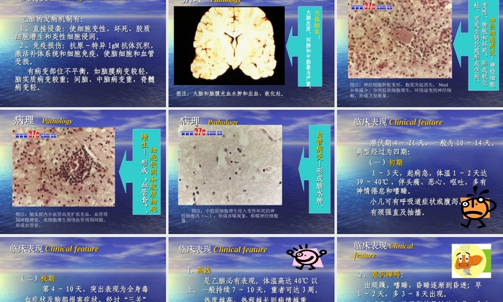 流行性乙型脑炎描述.ppt