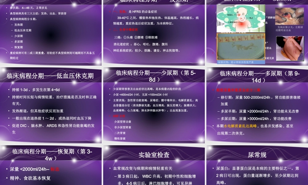 流行性出血热徐忠良.pptx