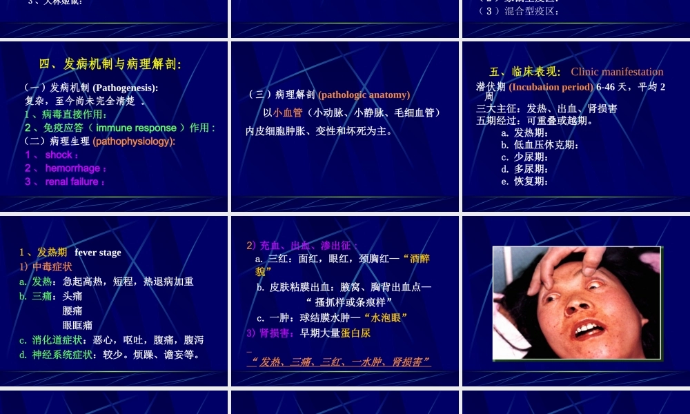 流行性出血热ppt.ppt