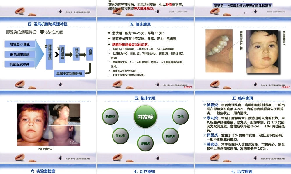 流行性腮腺炎PPt.pptx