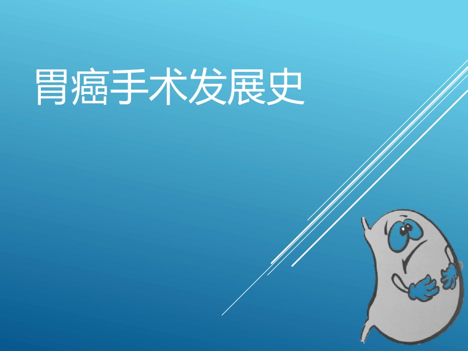 胃癌手术史.pptx_第1页