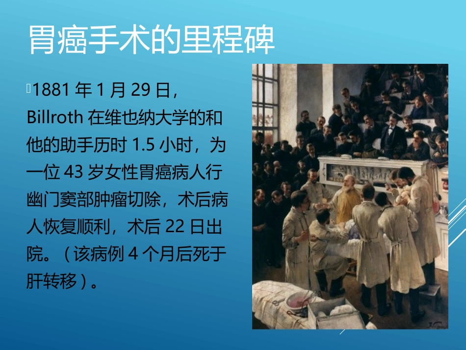 胃癌手术史.pptx_第3页