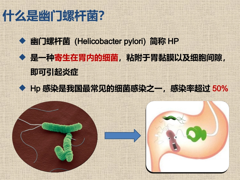 胃的不速之客—幽门螺杆菌.pptx_第2页