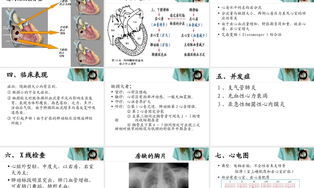 浅谈先天性心脏病.ppt