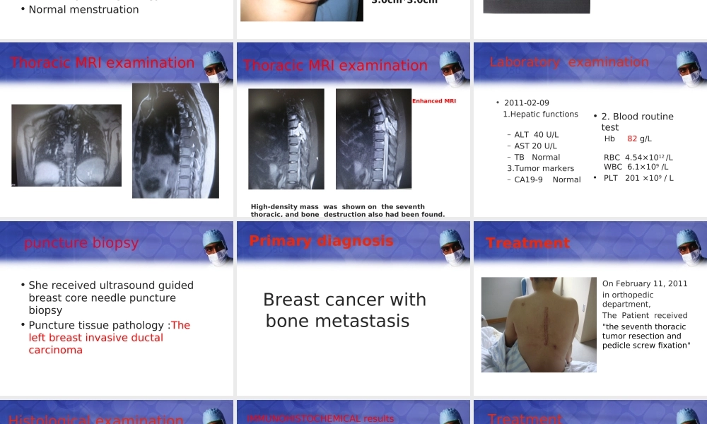 浅谈骨转移性乳腺癌.ppt