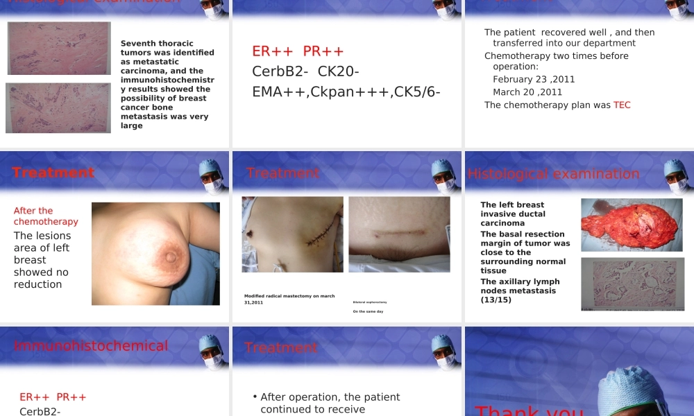 浅谈骨转移性乳腺癌.ppt