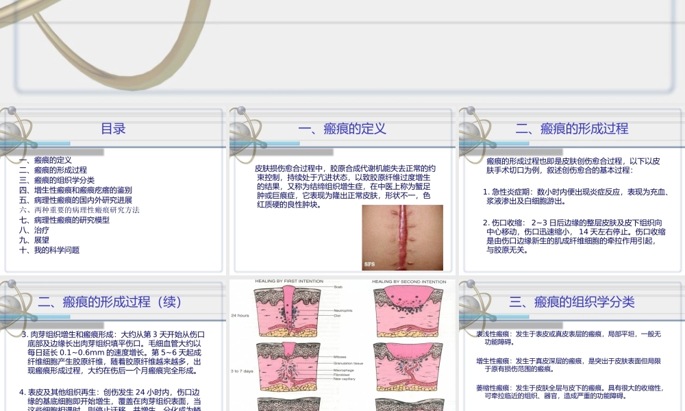 济南106医院分享：疤痕的国内外研究进展.ppt