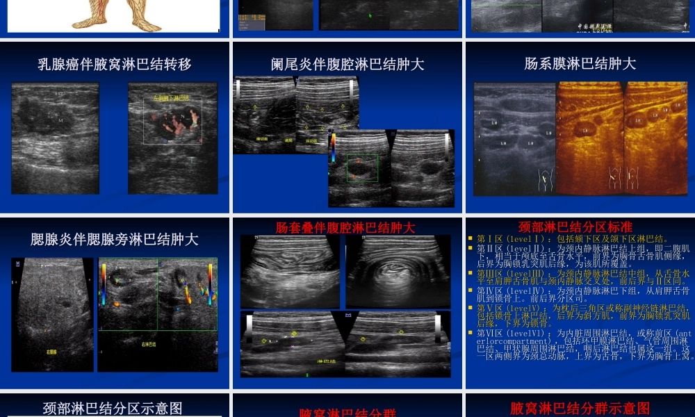 淋巴结超声检查.ppt
