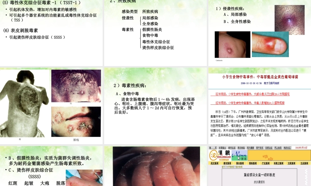 淋病奈瑟菌球形.ppt