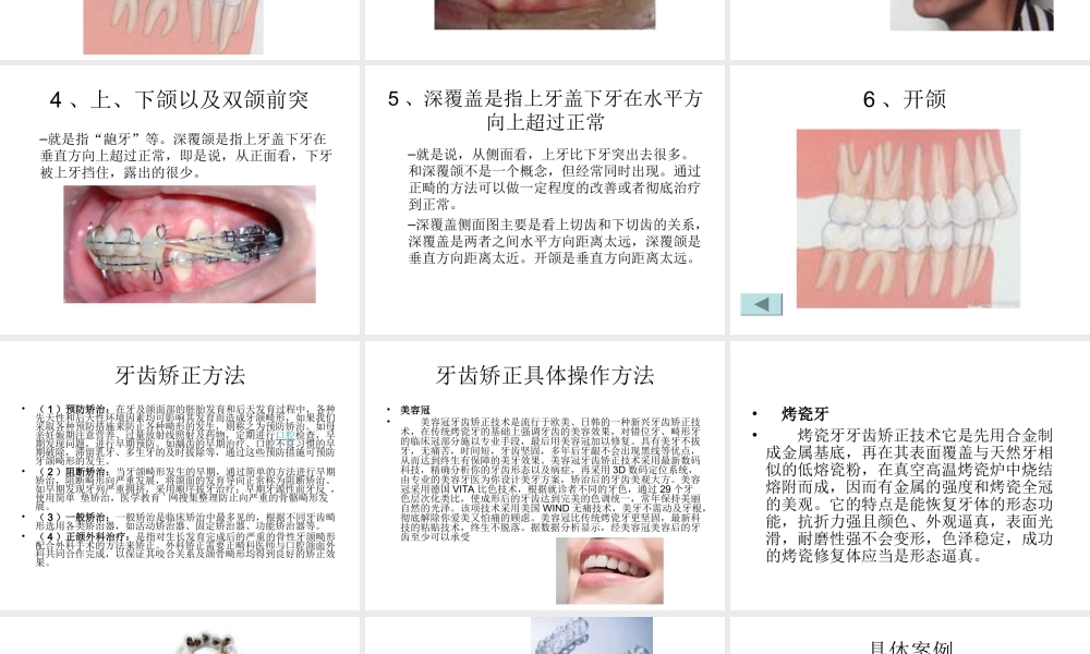 深圳矫正牙齿-口腔医院PPT.ppt