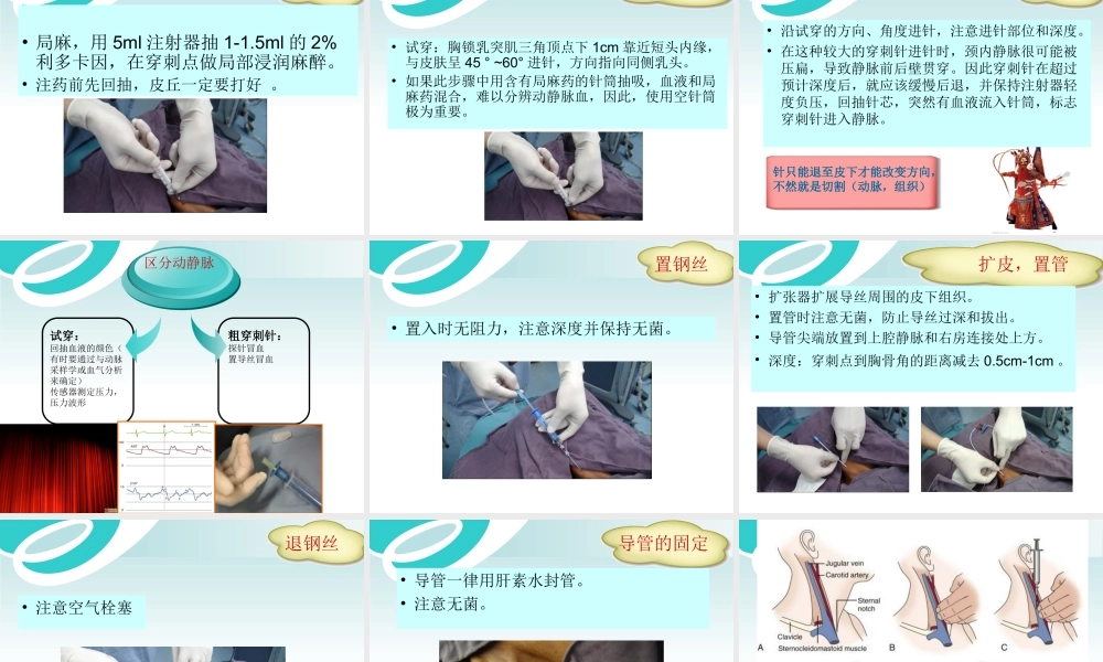 深静脉穿刺.ppt