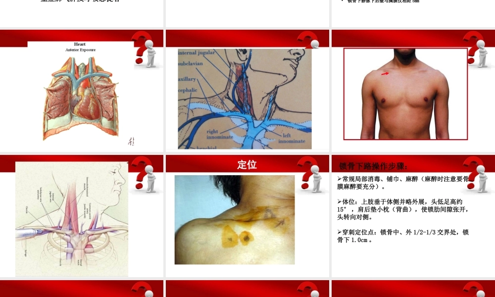 深静脉穿刺置管术(陈).ppt
