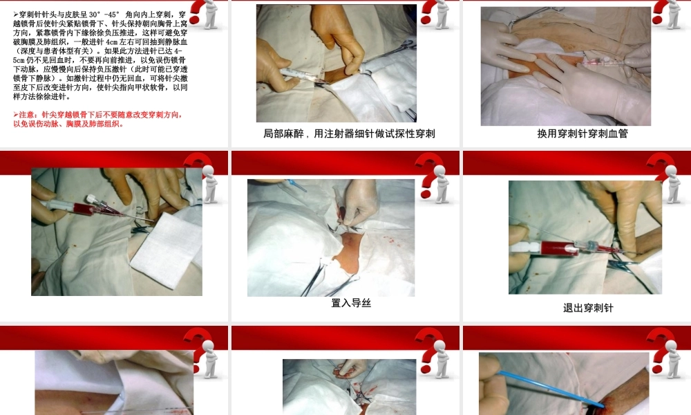 深静脉穿刺置管术(陈).ppt