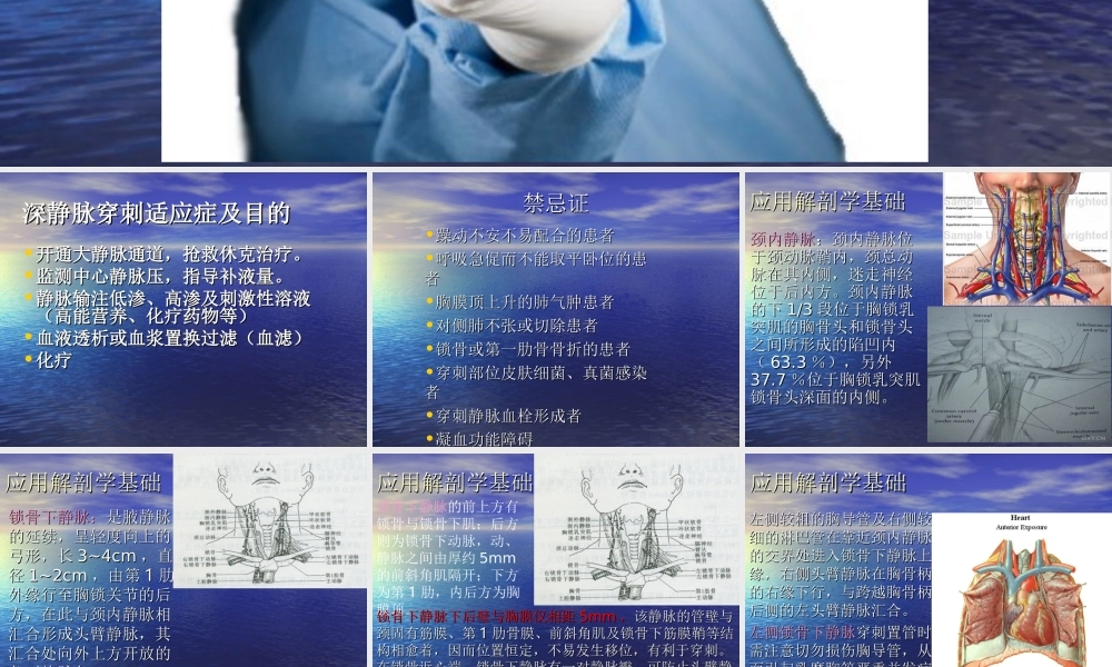 深静脉置管术2016.12.ppt