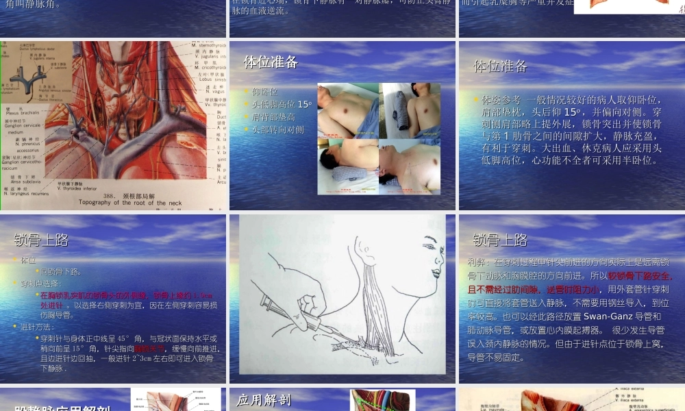 深静脉置管术2016.12.ppt