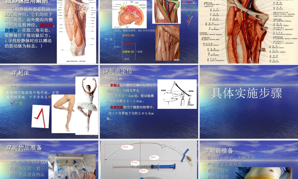 深静脉置管术2016.12.ppt